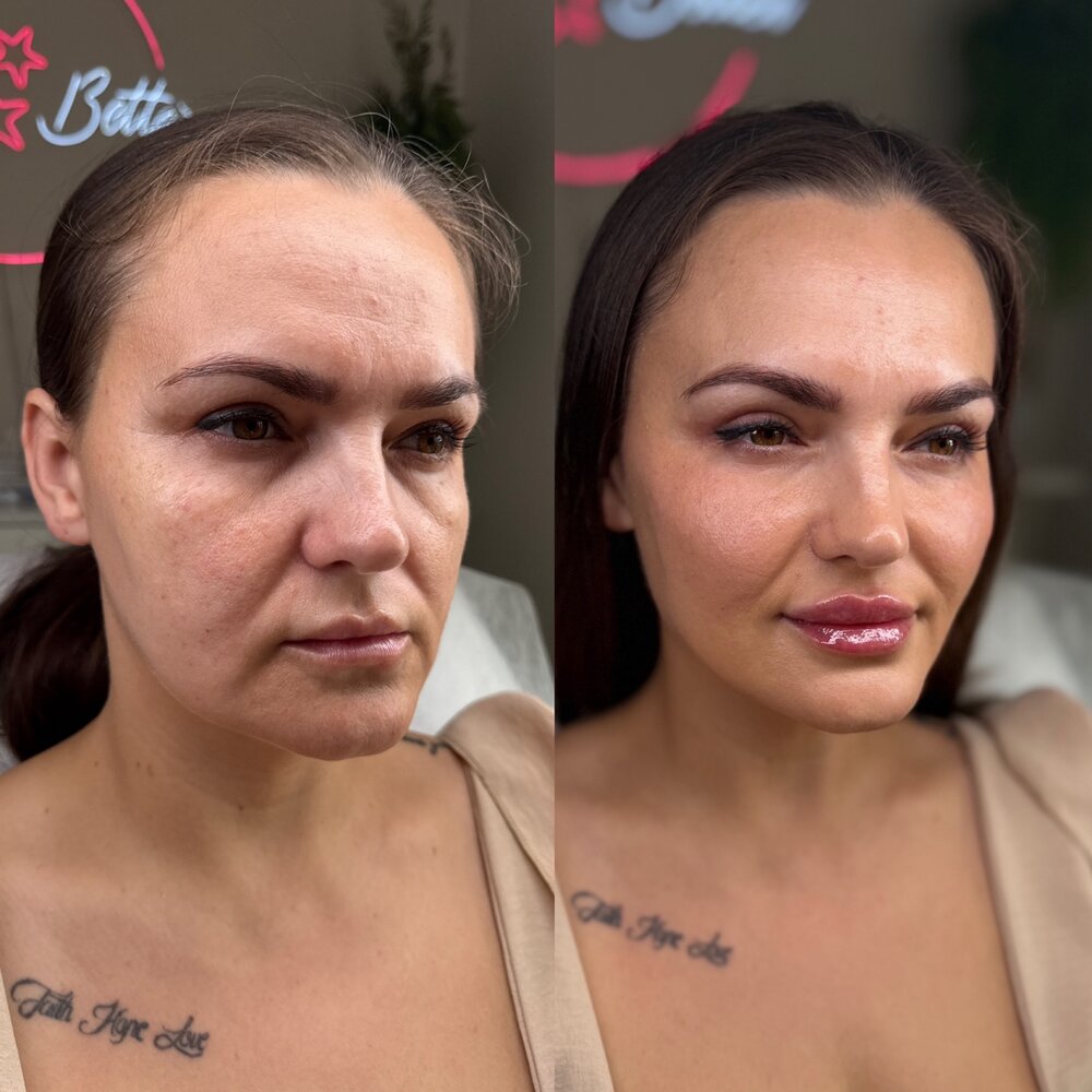 Efekt terapii estetycznej — before / after, LOOK BETTER